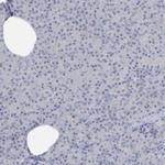 PERM1 Antibody in Immunohistochemistry (IHC)