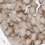 PERM1 Antibody in Immunohistochemistry (IHC)