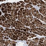 PERM1 Antibody in Immunohistochemistry (IHC)