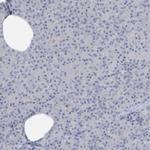 PERM1 Antibody in Immunohistochemistry (IHC)