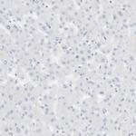 SPOCD1 Antibody in Immunohistochemistry (Paraffin) (IHC (P))