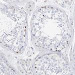 SPOCD1 Antibody in Immunohistochemistry (Paraffin) (IHC (P))