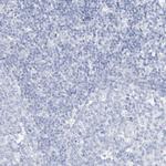 SPOCD1 Antibody in Immunohistochemistry (Paraffin) (IHC (P))