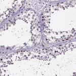 SPOCD1 Antibody in Immunohistochemistry (IHC)