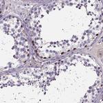 SPOCD1 Antibody in Immunohistochemistry (IHC)