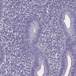 SPOCD1 Antibody in Immunohistochemistry (IHC)
