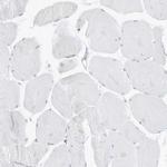 PGC Antibody in Immunohistochemistry (IHC)