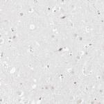 PGC Antibody in Immunohistochemistry (IHC)