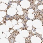 PHACTR2 Polyclonal Antibody