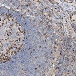 PHACTR2 Polyclonal Antibody
