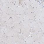 REC8 Antibody in Immunohistochemistry (Paraffin) (IHC (P))