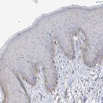 REC8 Antibody in Immunohistochemistry (Paraffin) (IHC (P))