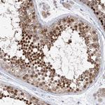 REC8 Antibody in Immunohistochemistry (Paraffin) (IHC (P))