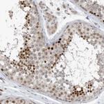 REC8 Polyclonal Antibody