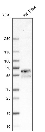 REC8 Antibody in Western Blot (WB)