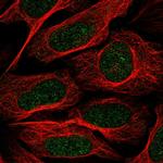 TAF8 Polyclonal Antibody