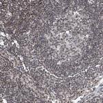 TAF8 Antibody in Immunohistochemistry (Paraffin) (IHC (P))