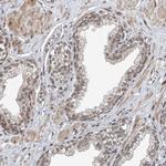 TAF8 Antibody in Immunohistochemistry (Paraffin) (IHC (P))