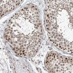 TAF8 Antibody in Immunohistochemistry (Paraffin) (IHC (P))