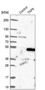 TAF8 Antibody in Western Blot (WB)