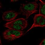 TAF8 Polyclonal Antibody