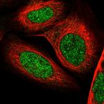 TAF8 Polyclonal Antibody