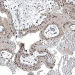 TAF8 Antibody in Immunohistochemistry (Paraffin) (IHC (P))