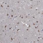 TTBK1 Antibody in Immunohistochemistry (Paraffin) (IHC (P))