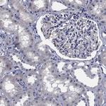 TTBK1 Antibody in Immunohistochemistry (Paraffin) (IHC (P))