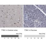 TTBK1 Antibody in Immunohistochemistry (IHC)