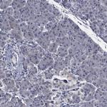 TTBK1 Antibody in Immunohistochemistry (IHC)