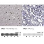 TTBK1 Antibody