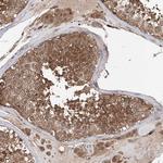 FAM135A Antibody in Immunohistochemistry (Paraffin) (IHC (P))