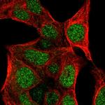 COLGALT2 Polyclonal Antibody