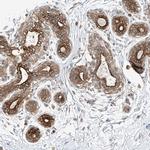 COLGALT2 Antibody in Immunohistochemistry (Paraffin) (IHC (P))