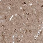 COLGALT2 Antibody in Immunohistochemistry (Paraffin) (IHC (P))