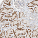 COLGALT2 Antibody in Immunohistochemistry (Paraffin) (IHC (P))