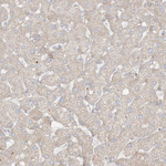 COLGALT2 Antibody in Immunohistochemistry (Paraffin) (IHC (P))