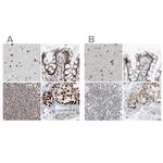 WHIP Polyclonal Antibody