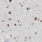 WHIP Antibody in Immunohistochemistry (IHC)