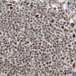 WHIP Antibody in Immunohistochemistry (IHC)