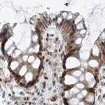 WHIP Antibody in Immunohistochemistry (IHC)