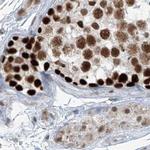 WHIP Antibody in Immunohistochemistry (IHC)