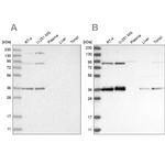 WHIP Antibody in Western Blot (WB)