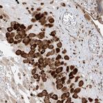 ZBTB8A Polyclonal Antibody