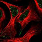 ZBTB8A Polyclonal Antibody