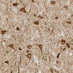 ZBTB8A Antibody in Immunohistochemistry (Paraffin) (IHC (P))