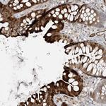 BCORL1 Antibody in Immunohistochemistry (Paraffin) (IHC (P))