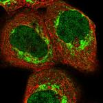 ZZEF1 Polyclonal Antibody