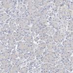 ZZEF1 Antibody in Immunohistochemistry (Paraffin) (IHC (P))